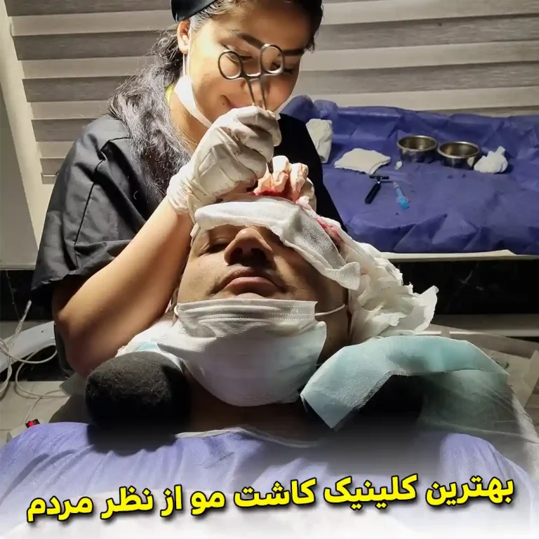 The-best-hair-transplant-clinic-according-to-people