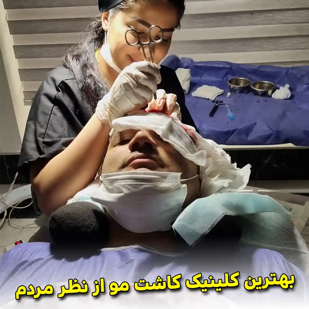 بهترین کلینیک کاشت مو از نظر مردم – کلینیک دکتر نیک