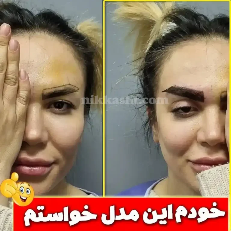 eyebrowtransplantnkksht123