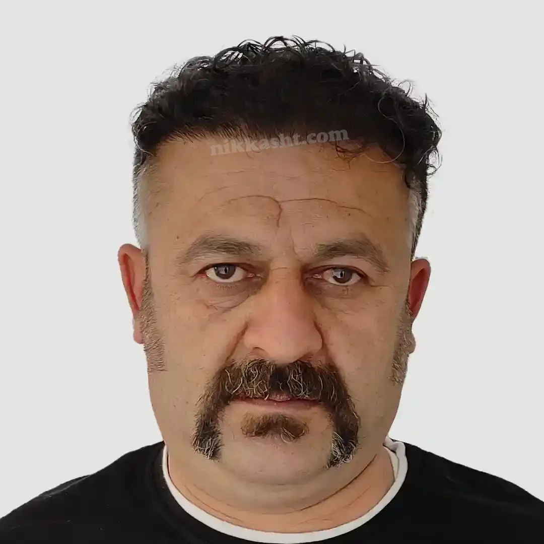 hairtransplant123drnk